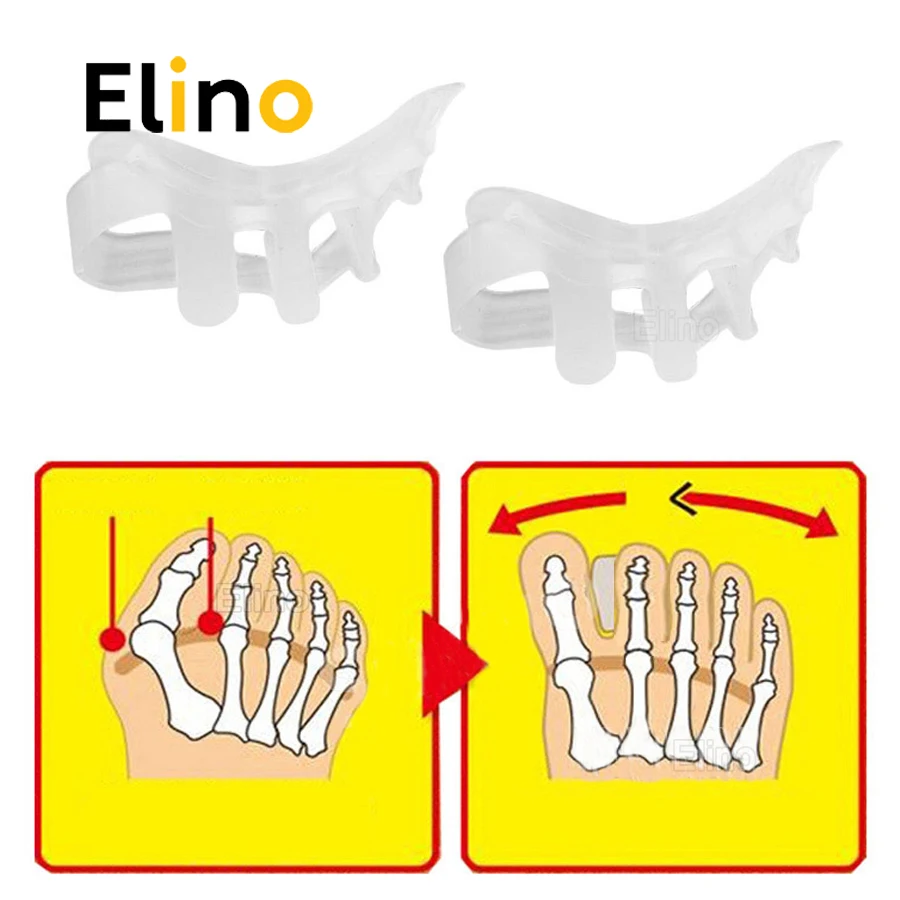 Toe Separator Correction Hallux Valgus Corrector for Separate All Toes Big Bone Orthopedic Straightener Foot Care Inserts Pad
Toe Separator Correction Hallux Valgus Corrector for Separate All Toes Big Bone Orthopedic Straightener Foot Care Inserts Pad
