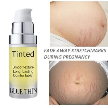 10ml Repair Cream Removal Fade Stretch Marks Scar Obesity Pattern Growth Pattern Gel Nourishing Maternity Body Skin Care TSLM1
10ml Repair Cream Removal Fade Stretch Marks Scar Obesity Pattern Growth Pattern Gel Nourishing Maternity Body Skin Care TSLM1
