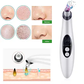 Acne Removing Apparatus Face Cleaner Pores Cleaner 4 Treatment Heads Fashion Effective Magic Massager Blackhead Vibration
Acne Removing Apparatus Face Cleaner Pores Cleaner 4 Treatment Heads Fashion Effective Magic Massager Blackhead Vibration