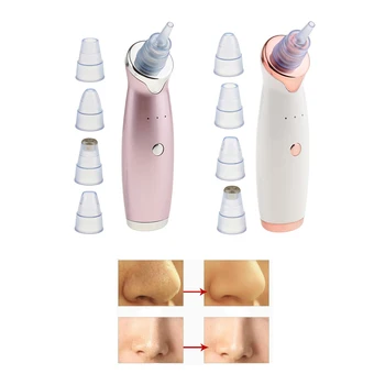 USB Charging Blackhead Remover 3 Level Oil Cleanser Lifting Firming Device
USB Charging Blackhead Remover 3 Level Oil Cleanser Lifting Firming Device