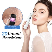 Facial Blackhead Remover Electric Acne Cleaner Blackhead Black Point Vacuum Cleaner Tool Black Spots Pore Cleaner Machine
Facial Blackhead Remover Electric Acne Cleaner Blackhead Black Point Vacuum Cleaner Tool Black Spots Pore Cleaner Machine