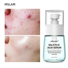 Salicylic Acid Remove Acne Face Serum Shrink Pores Whitening Essence Oil-Control Moisturizer Relieve Dryness Repairing Skin Care
Salicylic Acid Remove Acne Face Serum Shrink Pores Whitening Essence Oil-Control Moisturizer Relieve Dryness Repairing Skin Care