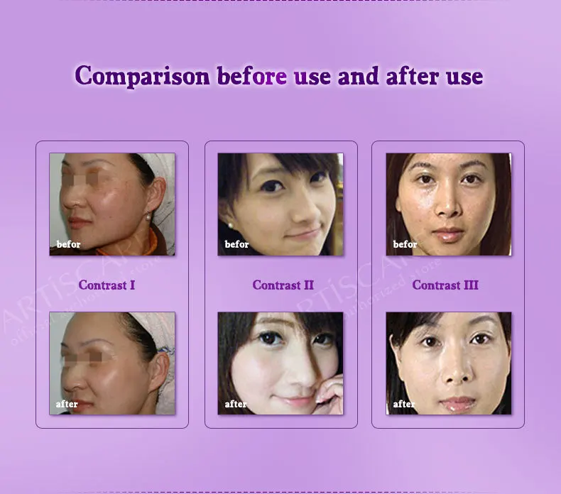 whitening-and-spot-correcting_08
