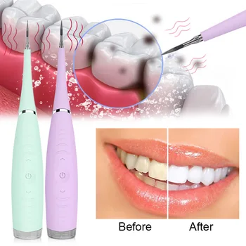 Electric Tartar Remover Smart Calculus for Calculus Tartar Tooth Stains Plaque Removal 3 Adjustable Modes & USB Rechargeable
Electric Tartar Remover Smart Calculus for Calculus Tartar Tooth Stains Plaque Removal 3 Adjustable Modes & USB Rechargeable