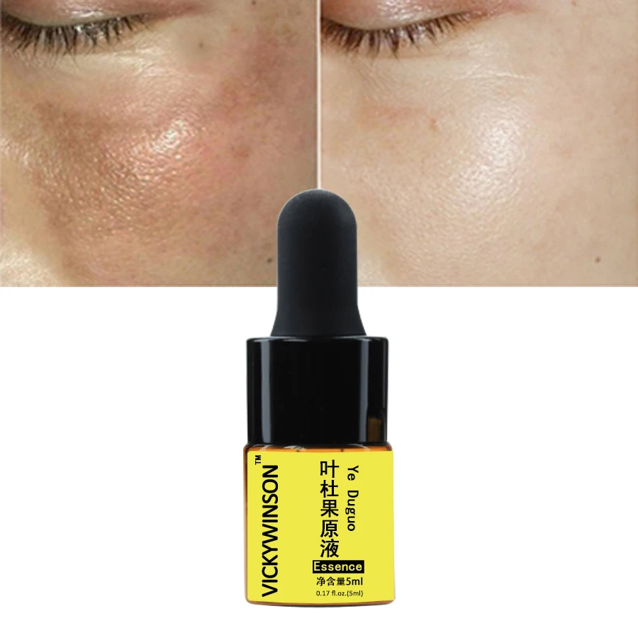 Ye Duguo essence 5ml Repair Eye Serum Whitening Moisturizing Anti-aging Wrinkle Remove Dark Circles Eye Care Eyes Serum
Ye Duguo essence 5ml Repair Eye Serum Whitening Moisturizing Anti-aging Wrinkle Remove Dark Circles Eye Care Eyes Serum