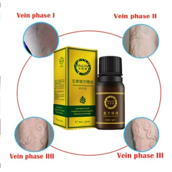 10ml Essential Oil Varicose Veins Treatment Vasculitis Leg Acid Itching Herbal Care Ointment Wormwood/ Ginger/Jojoba Seed Oil 
10ml Essential Oil Varicose Veins Treatment Vasculitis Leg Acid Itching Herbal Care Ointment Wormwood/ Ginger/Jojoba Seed Oil