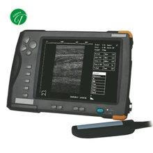 Hot Sell B/W Mode Handheld Portable Veterinary Ultrasound Scanner Machine for Vet
Hot Sell B/W Mode Handheld Portable Veterinary Ultrasound Scanner Machine for Vet