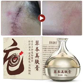Chinese Medicine Scar Creams For Face Remove Scar Blemish Surgery Scar Treatment Burns Cream Yu 
Chinese Medicine Scar Creams For Face Remove Scar Blemish Surgery Scar Treatment Burns Cream Yu