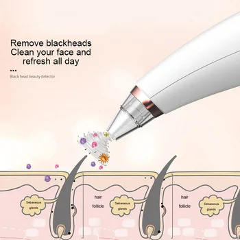 Vacuum Adsorption Blackhead Remove Fast Cleansing Skin Crush Acne Dry Battery Type For Face Convenient Beauty Instrumen
Vacuum Adsorption Blackhead Remove Fast Cleansing Skin Crush Acne Dry Battery Type For Face Convenient Beauty Instrumen