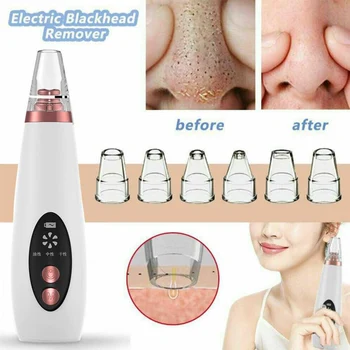 Blackhead Remover Face Pore Vacuum Skin Care Acne Pore Cleaner Pimple Removal Vacuum Suction Tools Usb Rechargeable Beauty Tool
Blackhead Remover Face Pore Vacuum Skin Care Acne Pore Cleaner Pimple Removal Vacuum Suction Tools Usb Rechargeable Beauty Tool