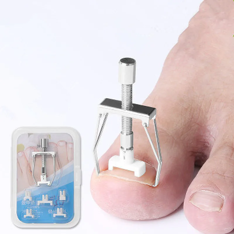 Вросший Носок инструмент для коррекции ногтей педикюр закрепитель на ногах Уход