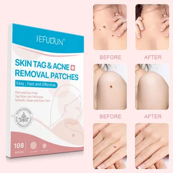108pcs Skin Tag Remover Ance Patch Skin Tags Treatment Get Rid Pimple Patch Hydrocolloid Herb Mild Wounded Skin Care Repair
108pcs Skin Tag Remover Ance Patch Skin Tags Treatment Get Rid Pimple Patch Hydrocolloid Herb Mild Wounded Skin Care Repair