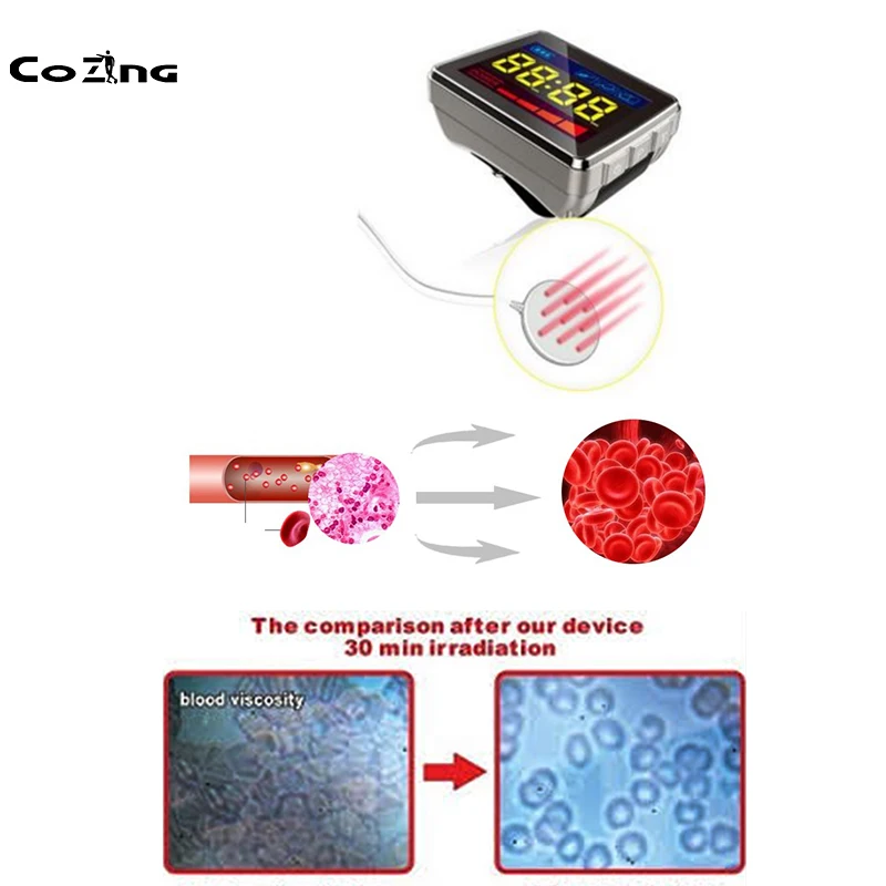 SemIconductor Laser Device Treat Soft Tissue,Wound Healing,Anti-Inflammatory And Postoperative Recovery
SemIconductor Laser Device Treat Soft Tissue,Wound Healing,Anti-Inflammatory And Postoperative Recovery