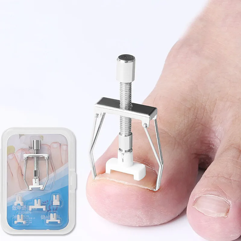 1 Set Ingrown Toe Nail Correction 6 Heads Pedicure Toenail Fixer Recover Toe Paronychia Orthotic Nail Corrector Foot Care Tools
1 Set Ingrown Toe Nail Correction 6 Heads Pedicure Toenail Fixer Recover Toe Paronychia Orthotic Nail Corrector Foot Care Tools