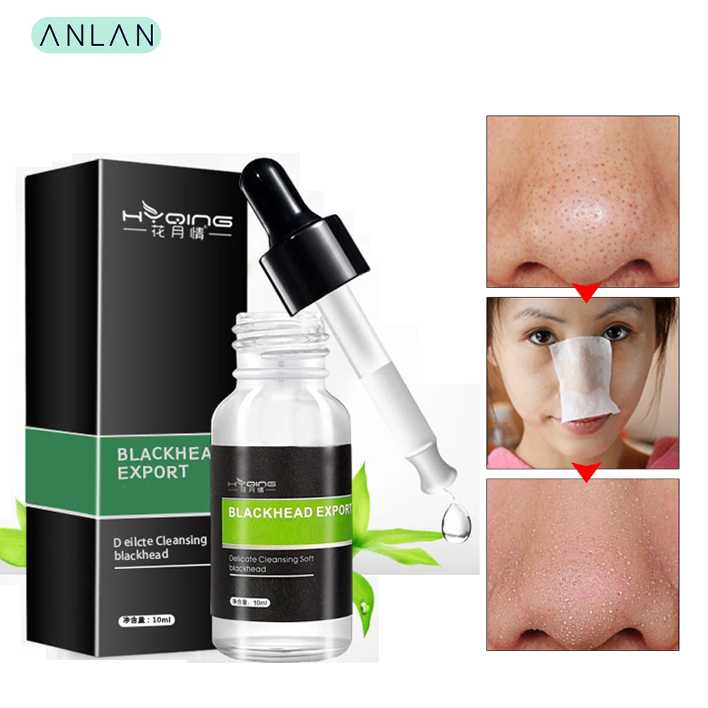 Deep Blackhead Softener Blackhead Liquid Derived Nose Head Black Remover Acne Treatment Deep Clean Skin Care 10ML
Deep Blackhead Softener Blackhead Liquid Derived Nose Head Black Remover Acne Treatment Deep Clean Skin Care 10ML