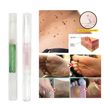 2020 New 3ml Skin Tags Remover Pen Skin Tags Genital Wart Remover Foot Corn Removal Pen Beauty Tool
2020 New 3ml Skin Tags Remover Pen Skin Tags Genital Wart Remover Foot Corn Removal Pen Beauty Tool