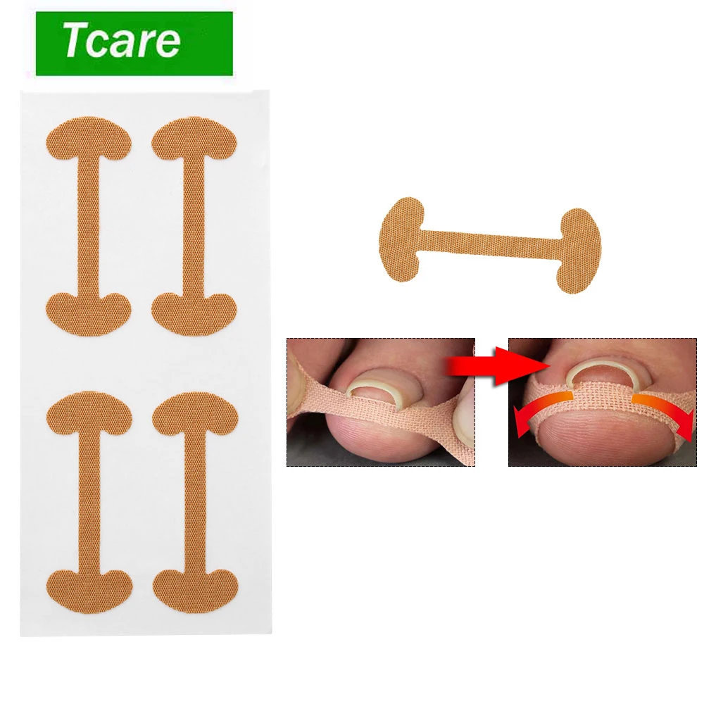 12Pcs/3Set Toe Nail Groove Foot Nail Orthodontic Device Thumb Nail Patch Quick Pedicure Toe Nail Deformation Recover
12Pcs/3Set Toe Nail Groove Foot Nail Orthodontic Device Thumb Nail Patch Quick Pedicure Toe Nail Deformation Recover