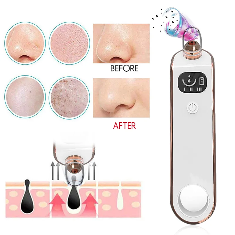 ABS Facial Clean Blackhead Removal Equipment Effective Black Head Cleaner Acne Cleaner Clear Fashion Beauty Health
ABS Facial Clean Blackhead Removal Equipment Effective Black Head Cleaner Acne Cleaner Clear Fashion Beauty Health