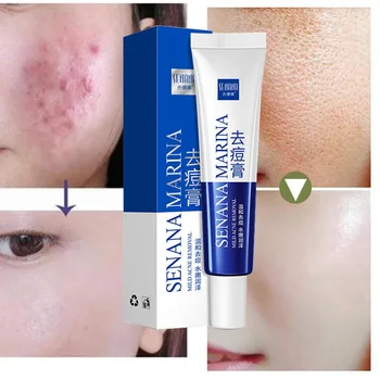 Okeny's Anti Acne Pimple Cream Repair Acne Scars Anti Inflammatory Face Beauty Smooth Skin Care Oil Control Vera Aloe Gel
Okeny's Anti Acne Pimple Cream Repair Acne Scars Anti Inflammatory Face Beauty Smooth Skin Care Oil Control Vera Aloe Gel