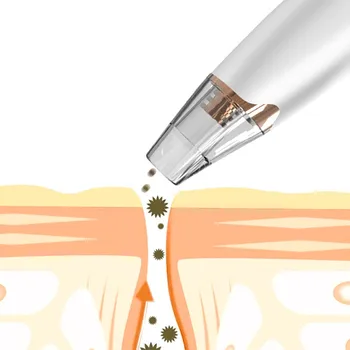 Powerful Blackhead Removal Suck Up Face Dirt Acne Pimple Deep Cleaner Facial Pore Zone Vacuum Electric Skin Clean Massage Tools
Powerful Blackhead Removal Suck Up Face Dirt Acne Pimple Deep Cleaner Facial Pore Zone Vacuum Electric Skin Clean Massage Tools