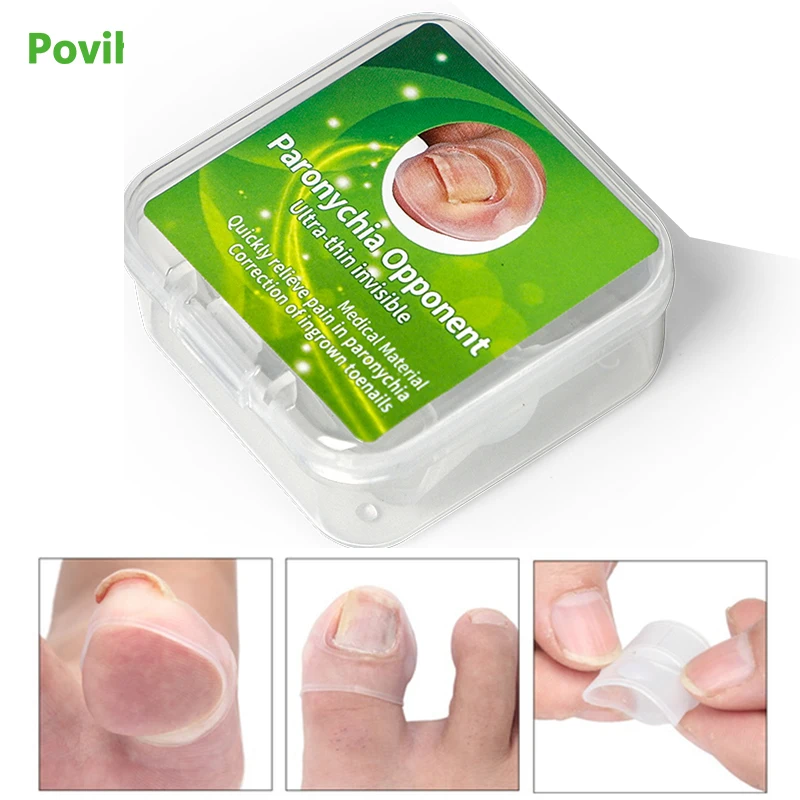New 2pcs/pair Invisible Ingrown Toe Nail Treatment Elastic Straightening Clip Brace Silicone Ingrown Toenail Correction Tools
New 2pcs/pair Invisible Ingrown Toe Nail Treatment Elastic Straightening Clip Brace Silicone Ingrown Toenail Correction Tools
