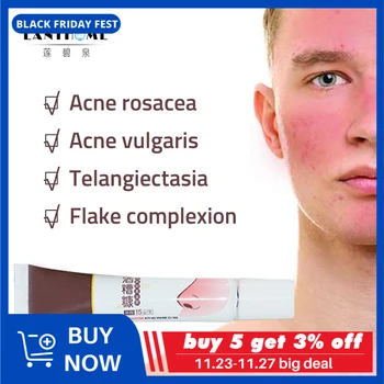 Natural Herbal Rosacea Ointmen Red Nose Antifungal Acne Cream Blackhead Remove Skin Redness Flushing Vaseline Acne Gel Treatment
Natural Herbal Rosacea Ointmen Red Nose Antifungal Acne Cream Blackhead Remove Skin Redness Flushing Vaseline Acne Gel Treatment