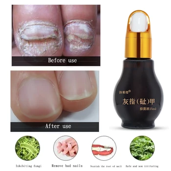 25ml Nail Repair Serum Fungal Nail Treatment Liquid Remove Onychomycosis Toe Essence Liquid Nourishing Hand Foot Care
25ml Nail Repair Serum Fungal Nail Treatment Liquid Remove Onychomycosis Toe Essence Liquid Nourishing Hand Foot Care