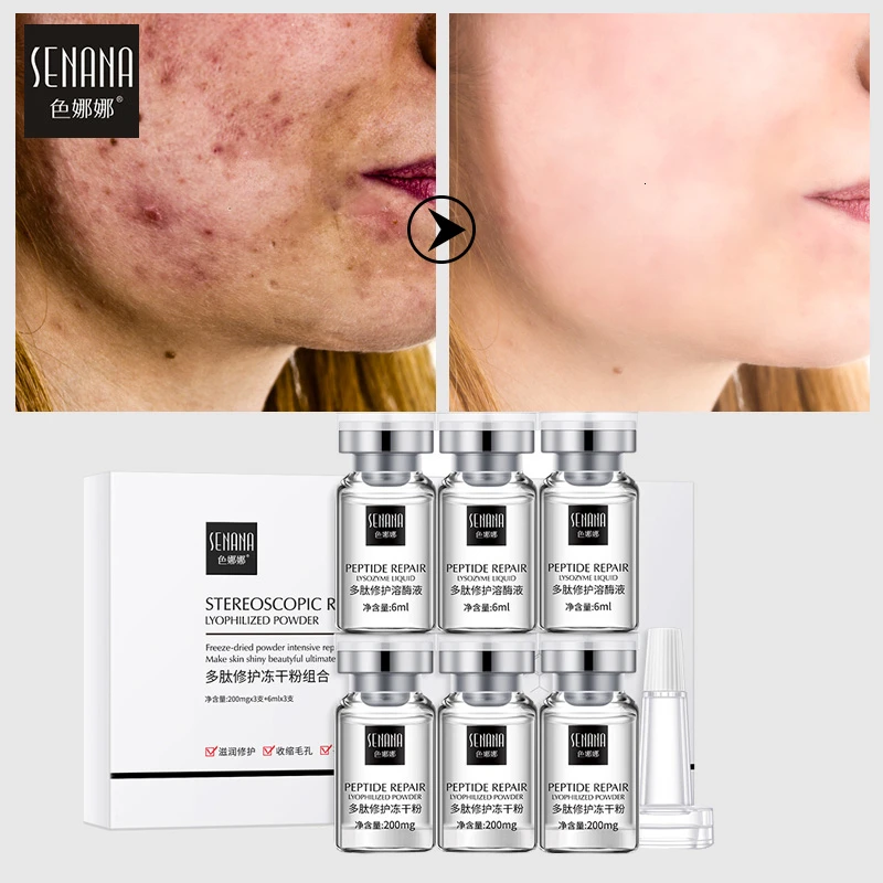 SENANA Peptide Repair Lyophilized Powder Serum Shrink Pores Acne Scars Pimples Treatment Epidermal Growth Factor Facial Care
SENANA Peptide Repair Lyophilized Powder Serum Shrink Pores Acne Scars Pimples Treatment Epidermal Growth Factor Facial Care