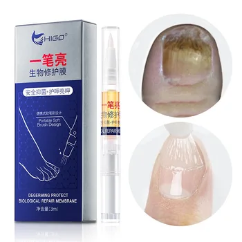 Fungal Nail Treatment Pen Toe Feet Care Solution Anti Fungal Nail Infection Onychomycosis Nails Repair Essence MKXJ 
Fungal Nail Treatment Pen Toe Feet Care Solution Anti Fungal Nail Infection Onychomycosis Nails Repair Essence MKXJ