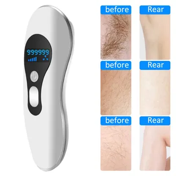 Painless Permanent IPL Pulse Photon Skin Rejuvenati Professional One-piece Durable Electric Body Hair Removal Laser Instrument
Painless Permanent IPL Pulse Photon Skin Rejuvenati Professional One-piece Durable Electric Body Hair Removal Laser Instrument