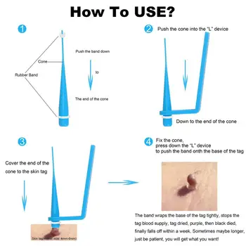 face Skin Tag Removal Tool skin tag remover Kill mole remove Medical Skin Tag wart treatment Acne Remover Cleansing Micro Band
face Skin Tag Removal Tool skin tag remover Kill mole remove Medical Skin Tag wart treatment Acne Remover Cleansing Micro Band