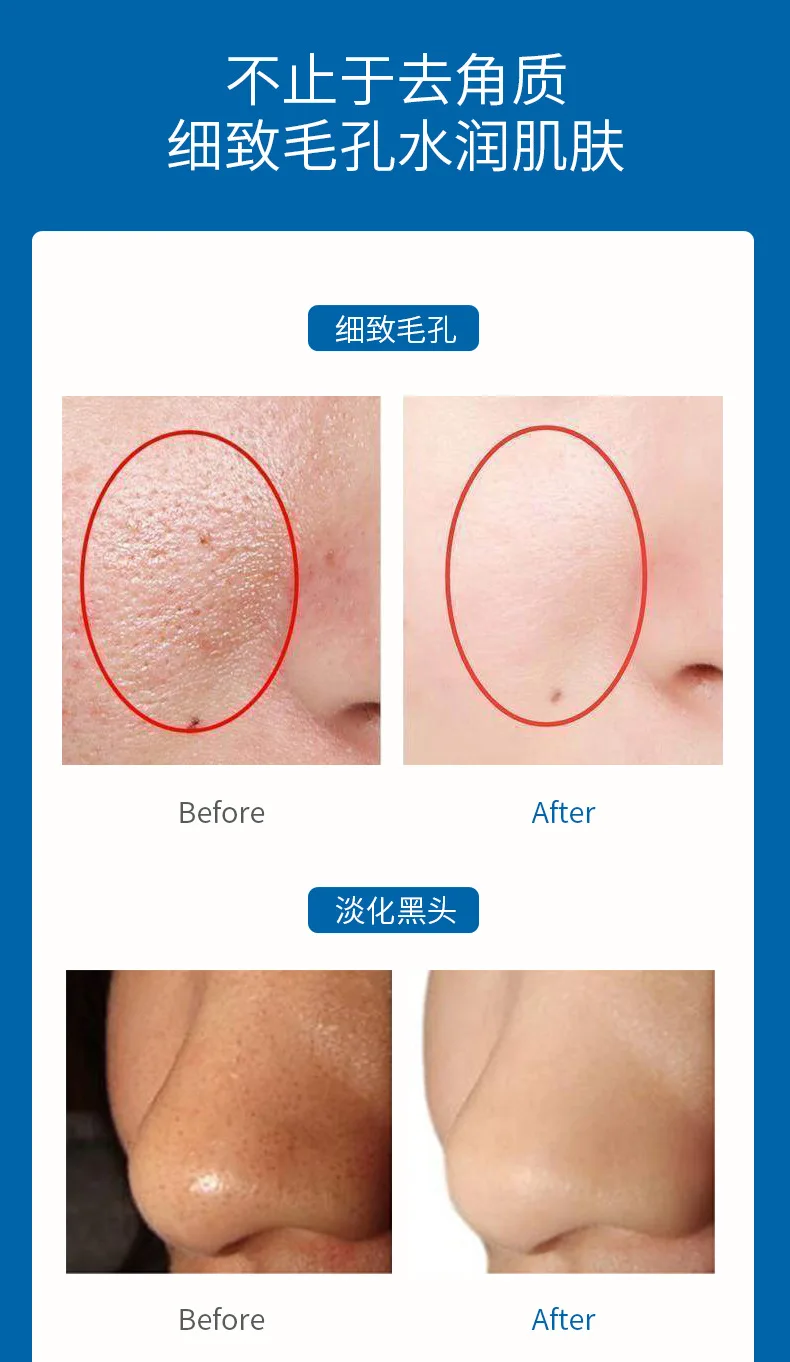 BSY24799-泊诗妍净爽水润去角质凝露3_11.jpg