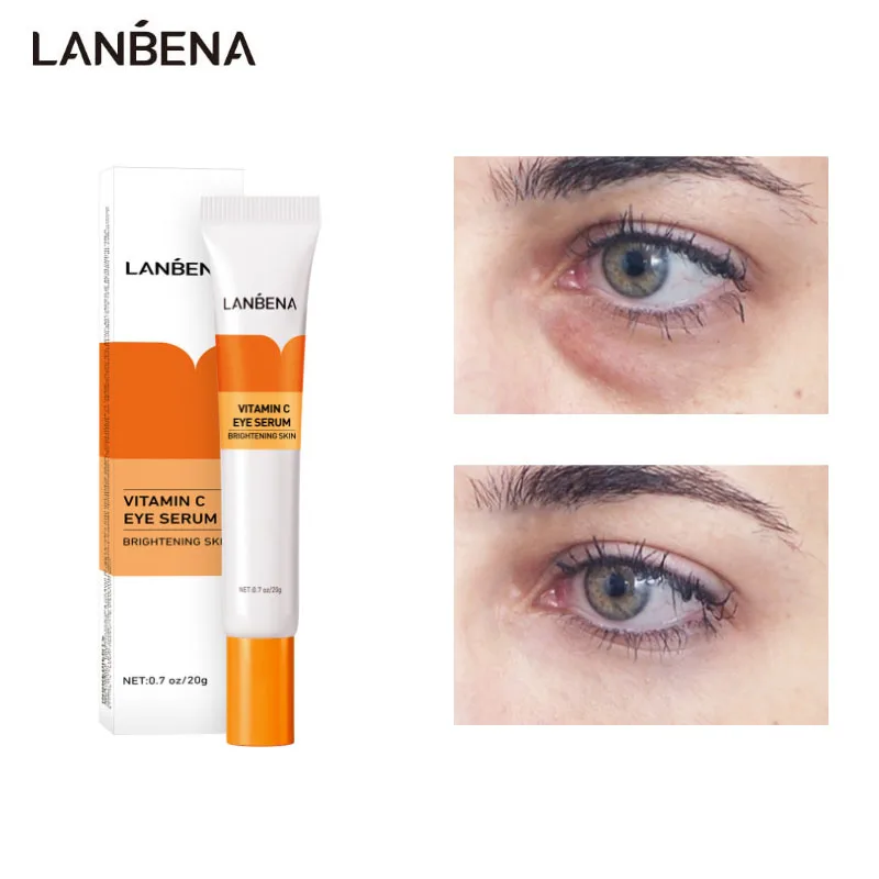 LANBENA Vitamin C Remove Dark Circles Eye Cream Nicotinamide Brighten Reduce Fine Line Anti-wrinkle Repair Black Eye Skin Care
LANBENA Vitamin C Remove Dark Circles Eye Cream Nicotinamide Brighten Reduce Fine Line Anti-wrinkle Repair Black Eye Skin Care