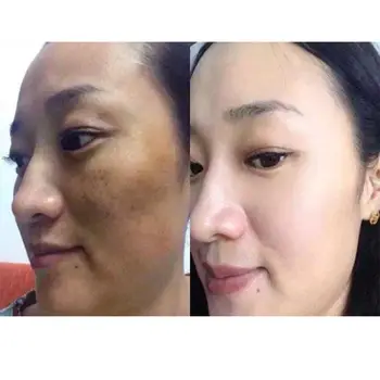 Resurrection Code MDR Cell Core Anti-Aging Reverse Growth Whitening Anti-wrinkle, anti-oxidant 15 packs/box
Resurrection Code MDR Cell Core Anti-Aging Reverse Growth Whitening Anti-wrinkle, anti-oxidant 15 packs/box