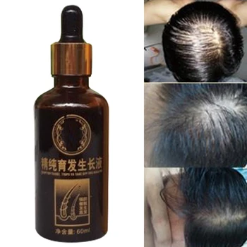 Hair Care Fast Powerful Hair Growth Products Regrowth Essence Liquid Treatment Preventing Hair Loss For Men Women 60ml oil 2 pcs 
Hair Care Fast Powerful Hair Growth Products Regrowth Essence Liquid Treatment Preventing Hair Loss For Men Women 60ml oil 2 pcs
