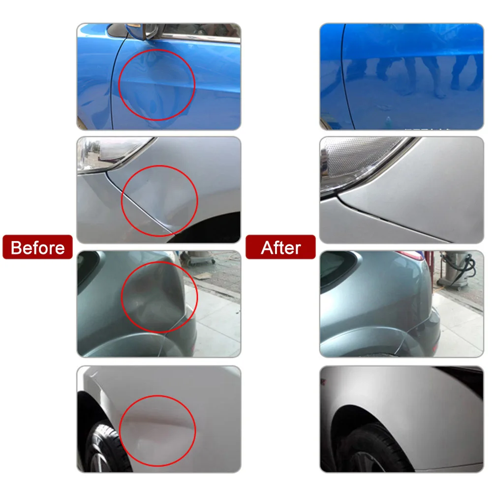 Paintless Dent New Repair Tools Kit Pops A Dent Removal Bridge Puller Set Car Dent Removal for Auto Automobile Body Refrigerator
Paintless Dent New Repair Tools Kit Pops A Dent Removal Bridge Puller Set Car Dent Removal for Auto Automobile Body Refrigerator