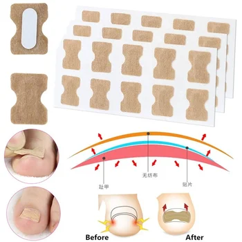 Glue-free Toe Nail Inlay Corrector Positive Nail Strip Anti-roll Nail-free Nail Patch Pull Manicure Special Toenail Deformation
Glue-free Toe Nail Inlay Corrector Positive Nail Strip Anti-roll Nail-free Nail Patch Pull Manicure Special Toenail Deformation