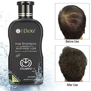 Useful Anti-Hair Loss Shampoo Improve Hair Quality Natural Herbal Extract Shampoo
Useful Anti-Hair Loss Shampoo Improve Hair Quality Natural Herbal Extract Shampoo