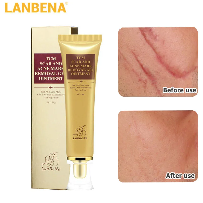 LANBENA Acne Scar Removal Face Cream Remove Acne Spots Scar Repair Stretch Marks Pigmentation Corrector Whitening Gel Skin Care
LANBENA Acne Scar Removal Face Cream Remove Acne Spots Scar Repair Stretch Marks Pigmentation Corrector Whitening Gel Skin Care