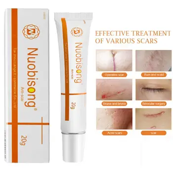 20g Removal Acne Scars Stretch Marks Cream Repair Scar Cream Surgical Scar Burn For Body Pigmentation Corrector Care
20g Removal Acne Scars Stretch Marks Cream Repair Scar Cream Surgical Scar Burn For Body Pigmentation Corrector Care