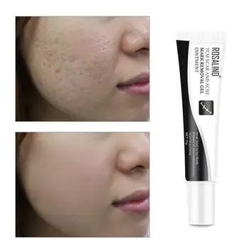 ROSALIND Scar Acne Mark Remove Anti inflammatory and Repair Skin Cream Essence of Ginseng
ROSALIND Scar Acne Mark Remove Anti inflammatory and Repair Skin Cream Essence of Ginseng