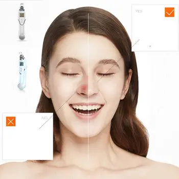 Electric Blackhead Removing Instrument Artifact Household Cold And Hot Cleansing And Skin Rejuvenation Beauty Instrument
Electric Blackhead Removing Instrument Artifact Household Cold And Hot Cleansing And Skin Rejuvenation Beauty Instrument