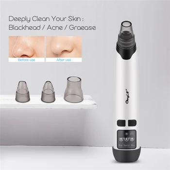 4 in 1 Vacuum Suction Blackhead Remover Hot Compress Acne Comedone Extractor Dead Skin Remover Electric Facial Cleaning Kit 31
4 in 1 Vacuum Suction Blackhead Remover Hot Compress Acne Comedone Extractor Dead Skin Remover Electric Facial Cleaning Kit 31