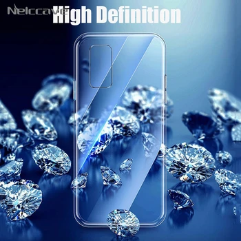 100Pcs Ultra Thin TPU Case For Huawei Honor 30 Pro 30S 20 Lite 20i V20 10 V10 10i 9 9X 8S 8A 7X Transparent Silicone Clear Cover
100Pcs Ultra Thin TPU Case For Huawei Honor 30 Pro 30S 20 Lite 20i V20 10 V10 10i 9 9X 8S 8A 7X Transparent Silicone Clear Cover