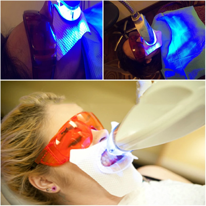 New Cold Light Teeth Whitening Protection Pad Anti - Drug Surface Pad Oral Care Tools Oral Treatment Disposable Tooth Whitening
New Cold Light Teeth Whitening Protection Pad Anti - Drug Surface Pad Oral Care Tools Oral Treatment Disposable Tooth Whitening