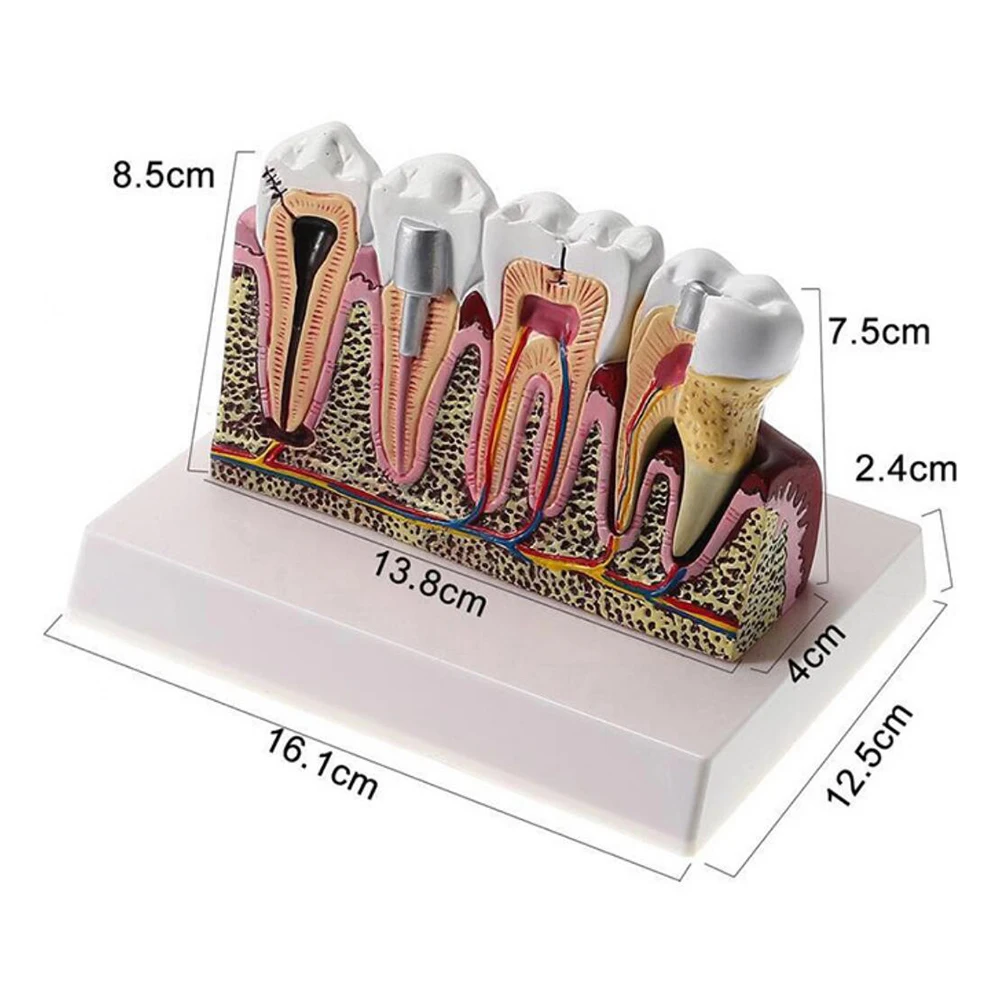 1pcs Detachable Dental Anatomy of dental caries plastic teeth model demonstration communication
1pcs Detachable Dental Anatomy of dental caries plastic teeth model demonstration communication