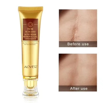 30ml Fast Effective Acne Scar Removal Cream Skin Repair Face Acne Spots Acne Treatment Blackhead Whitening Cream Stretch Marks 
30ml Fast Effective Acne Scar Removal Cream Skin Repair Face Acne Spots Acne Treatment Blackhead Whitening Cream Stretch Marks