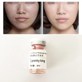 8ml Hyaluronic Acid Serum Solution face Skin Care Whiten Brighten Anti Aging for hyaluron pen atomizer injection mesotherapy gun
8ml Hyaluronic Acid Serum Solution face Skin Care Whiten Brighten Anti Aging for hyaluron pen atomizer injection mesotherapy gun