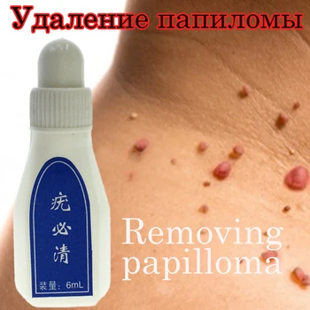 Genital Wart Treatment Papillomas Removal of Warts Liquid From Skin Tags Removing Against Moles Remover Anti Verruca Remedy 6ml
Genital Wart Treatment Papillomas Removal of Warts Liquid From Skin Tags Removing Against Moles Remover Anti Verruca Remedy 6ml