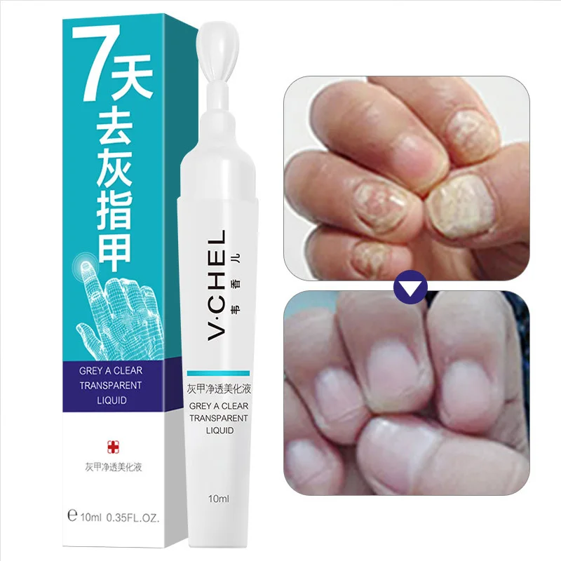 2019 droppshiping Fungal Nail Treatment Pen Effective Onychomycosis Paronychia Infection Gel Nails Care 10ML M2
2019 droppshiping Fungal Nail Treatment Pen Effective Onychomycosis Paronychia Infection Gel Nails Care 10ML M2